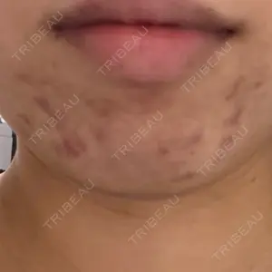 ルラ美容クリニック ルラ美容クリニック 福岡本院口コミ