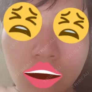 HANABI整形外科口コミ