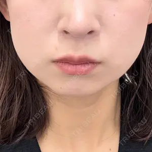 ルラ美容クリニック ルラ美容クリニック 広島院口コミ