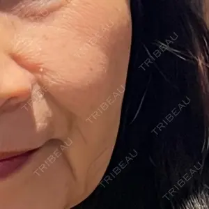 新宿ラクル美容外科クリニック 新宿院の