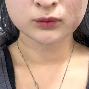 新未来クリニック口コミ