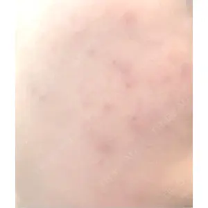 AURORA CLINIC（オーロラクリニック）新宿院口コミ