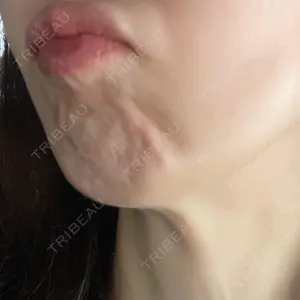 口コミ