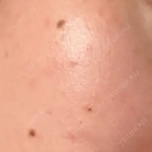 BBC BBC表参道院口コミ