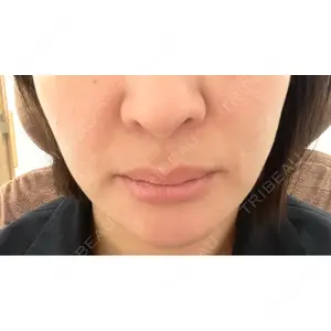 ヴェリテクリニック ヴェリテクリニック 銀座院口コミ