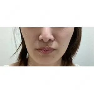 ビラビューティークリニック 博多美容外科/美容皮膚科 ビラビューティークリニック口コミ