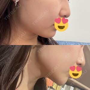 エースクリニック エースクリニック 大阪梅田HEPナビオ院口コミ