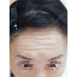 東京形成美容外科 東京形成美容外科 船橋院口コミ