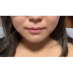 新宿Ladies&Gentlemen美容クリニック口コミ