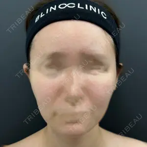 BLINC CLINIC （ブリンク クリニック）口コミ