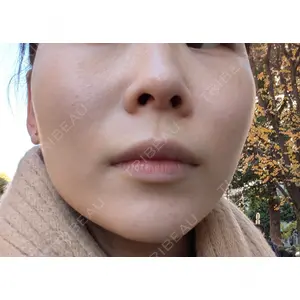 ルラ美容クリニック ルラ美容クリニック 池袋院口コミ