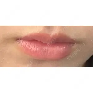 口コミ