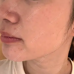 Chloe Cheongdam Clinic （クロエチョンダムクリニック）口コミ