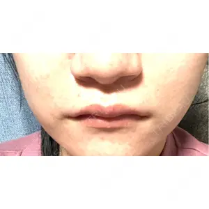 アイビークリニック 千葉美容外科アイビークリニック口コミ