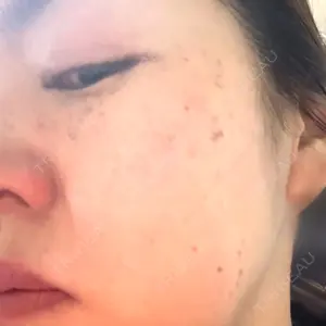 聖心美容クリニック グループ S-Laboクリニック 渋谷院口コミ