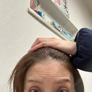 TCB東京中央美容外科 TCB東京中央美容外科 姫路院口コミ