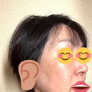さっぽろ美容クリニック口コミ