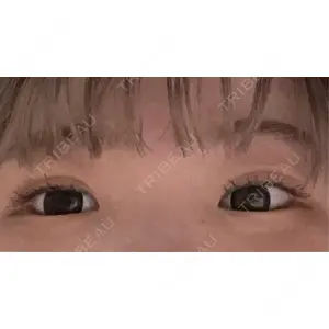 フィラークリニック フィラークリニック 大阪梅田院口コミ