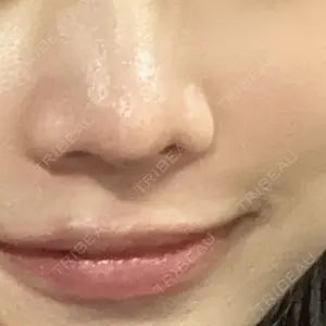 B-LINE CLINIC B-LINE CLINIC 大阪院口コミ