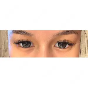 HAAB CLINIC HAAB BEAUTY CLINIC 名古屋院口コミ