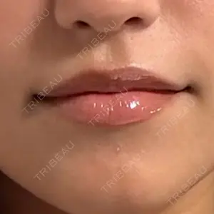 HAAB CLINIC HAAB BEAUTY CLINIC 名古屋院口コミ