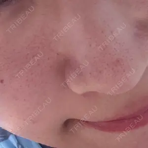 トラスト美容クリニック トラスト美容クリニック 銀座院口コミ