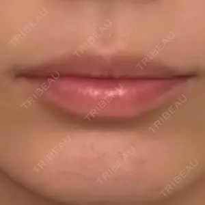 フィラークリニック フィラークリニック 大阪心斎橋院口コミ