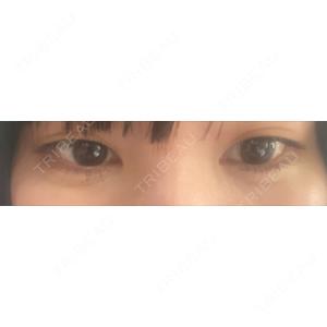 BITO BEAUTY CLINIC BITO BEAUTY CLINIC口コミ
