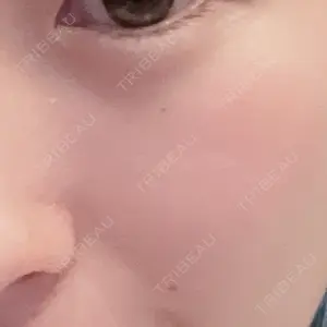 TCB東京中央美容外科 TCB東京中央美容外科 名古屋栄院口コミ