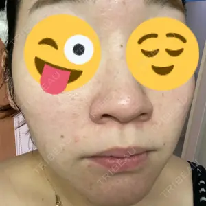 アクティブエイジクリニック アクティブエイジクリニック口コミ