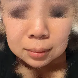 聖心美容クリニック グループ S-Laboクリニック 渋谷院口コミ