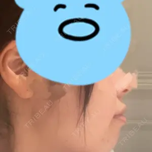 HAAB CLINIC HAAB×DREAM BEAUTY CLINIC 東京本院口コミ