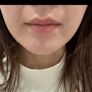 ビラビューティークリニック 博多美容外科/美容皮膚科 ビラビューティークリニック口コミ