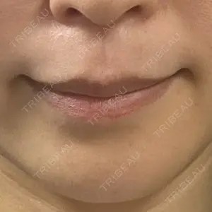 Wクリニック Wクリニック 梅田院口コミ