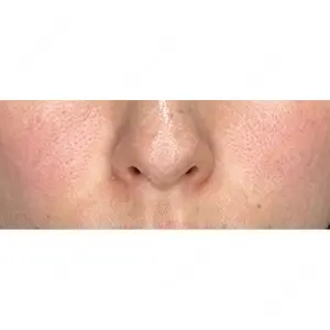 NARU Beauty Clinic NARU Beauty Clinic 【ナルクリ】 水戸院口コミ