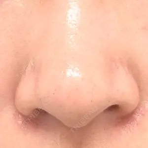 日本美容・医療クリニック 日本美容・医療クリニック 六本木院口コミ