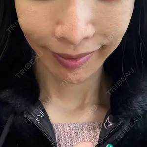 PRISM Beauty Clinic  PRISM Beauty Clinic 新宿院口コミ