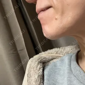ルラ美容クリニック ルラ美容クリニック 町田院口コミ