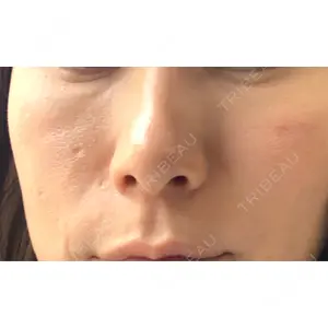 TAクリニック 新宿TAクリニック口コミ