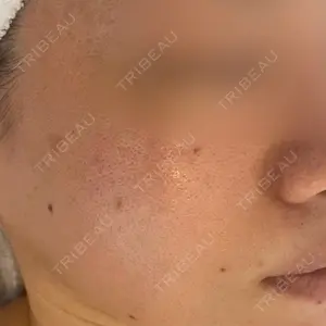 おおたかの森ビューティークリニック おおたかの森ビューティークリニック口コミ