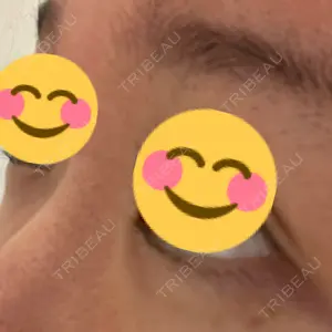 プロクリニック PRO CLINIC プロクリニック 銀座院口コミ
