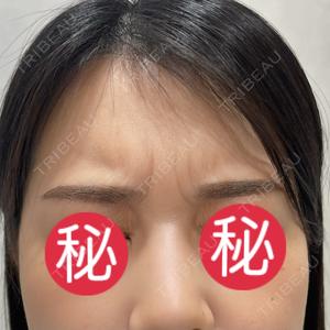 フォンタナクリニック天神口コミ