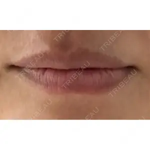 アネシス美容クリニック口コミ