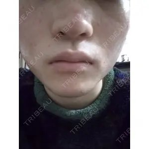 ルラ美容クリニック ルラ美容クリニック 札幌本院口コミ