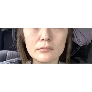 おおたかの森ビューティークリニック おおたかの森ビューティークリニック口コミ