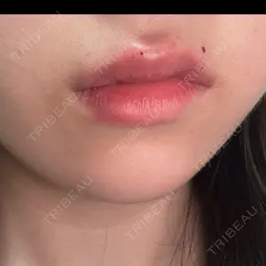 AZ BEAUTY CLINIC口コミ