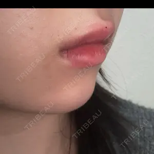 AZ BEAUTY CLINIC口コミ
