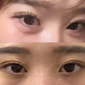 プロクリニック PRO CLINIC プロクリニック 銀座院口コミ