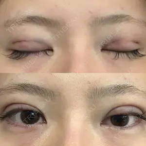 アリエル美容クリニック アリエル美容クリニック 郡山院口コミ