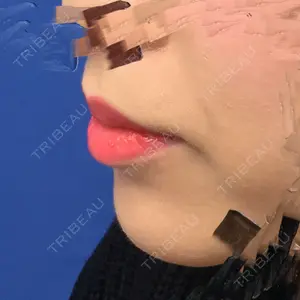 ライク整形外科口コミ